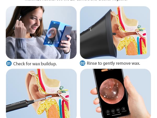 ear wax flushing kit