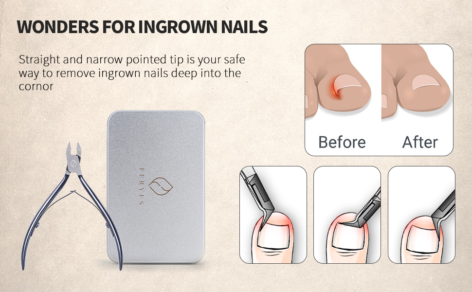 nail clippers for ingrown nails toenail clipper for ingrown toenails straight cut toenail nipper