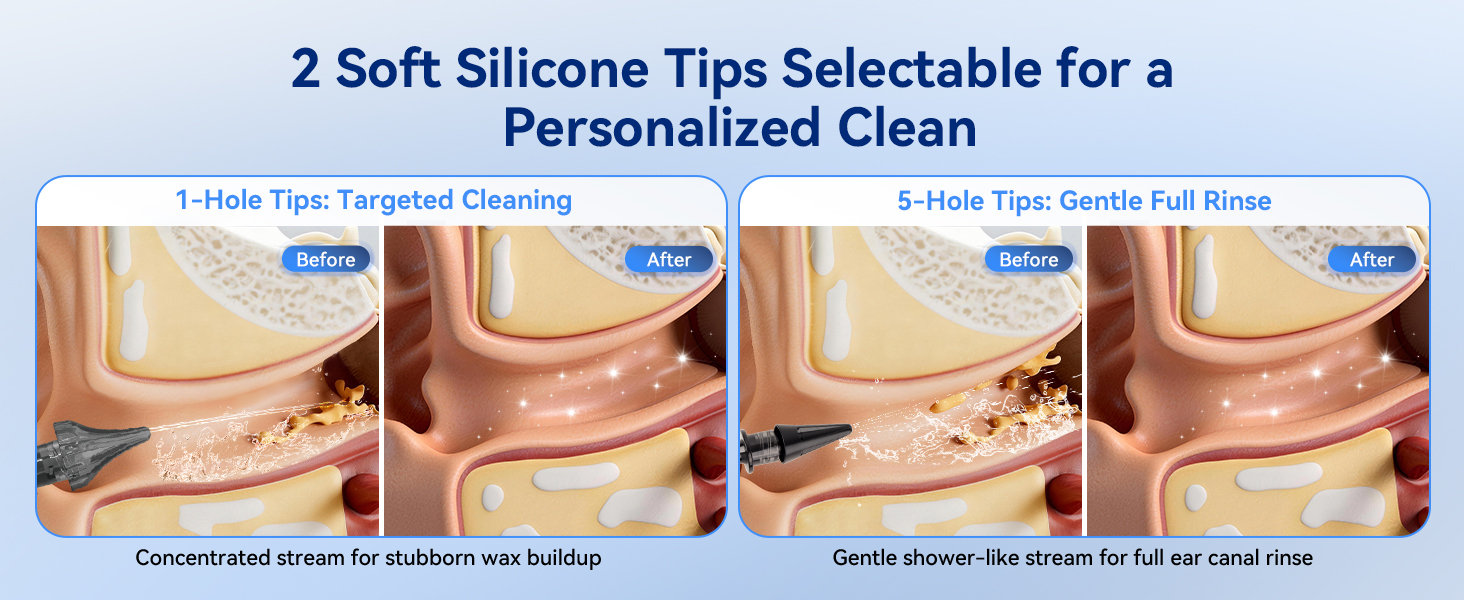 Smart Ear Cleaner_1464_03-3
