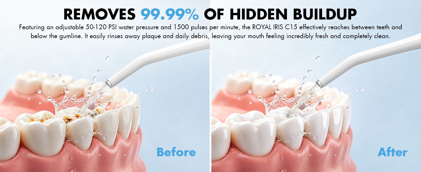 power dental flossers