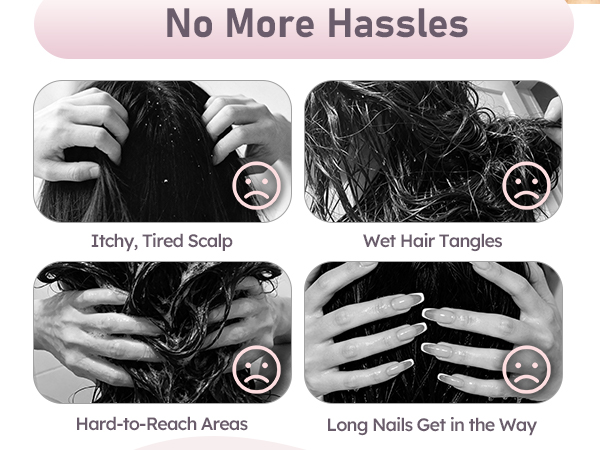 scalp brush for dandruff removal