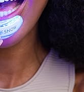 whitening teeth kit