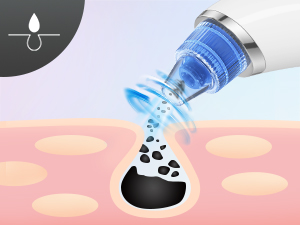 blackhead vacuum blackhead remover vacuum pore vacuum