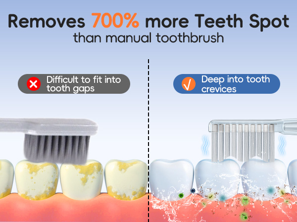 Removes 700% more Teeth Spotthan manual toothbrush