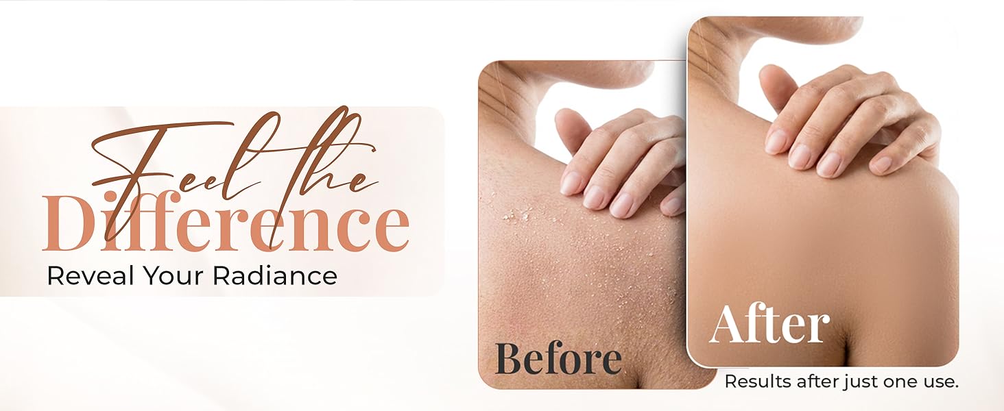 before and afer use of our L'Exfose exfoliating glove