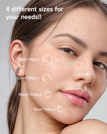 pimple patches