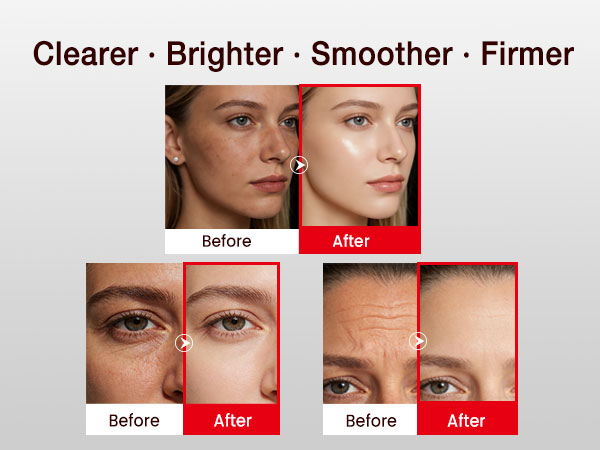 face roller lymphatic drainage
