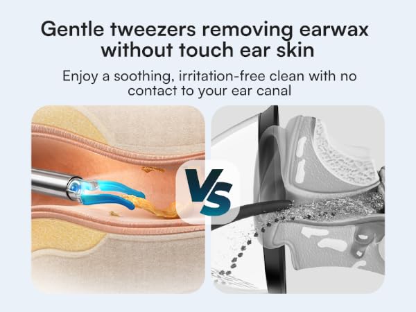 Gentle tweezers removing earwax, without touch ear skin