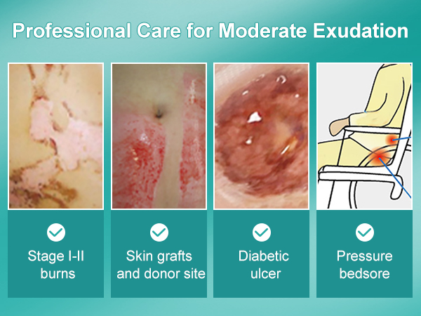 Hydrocolloid Dressing