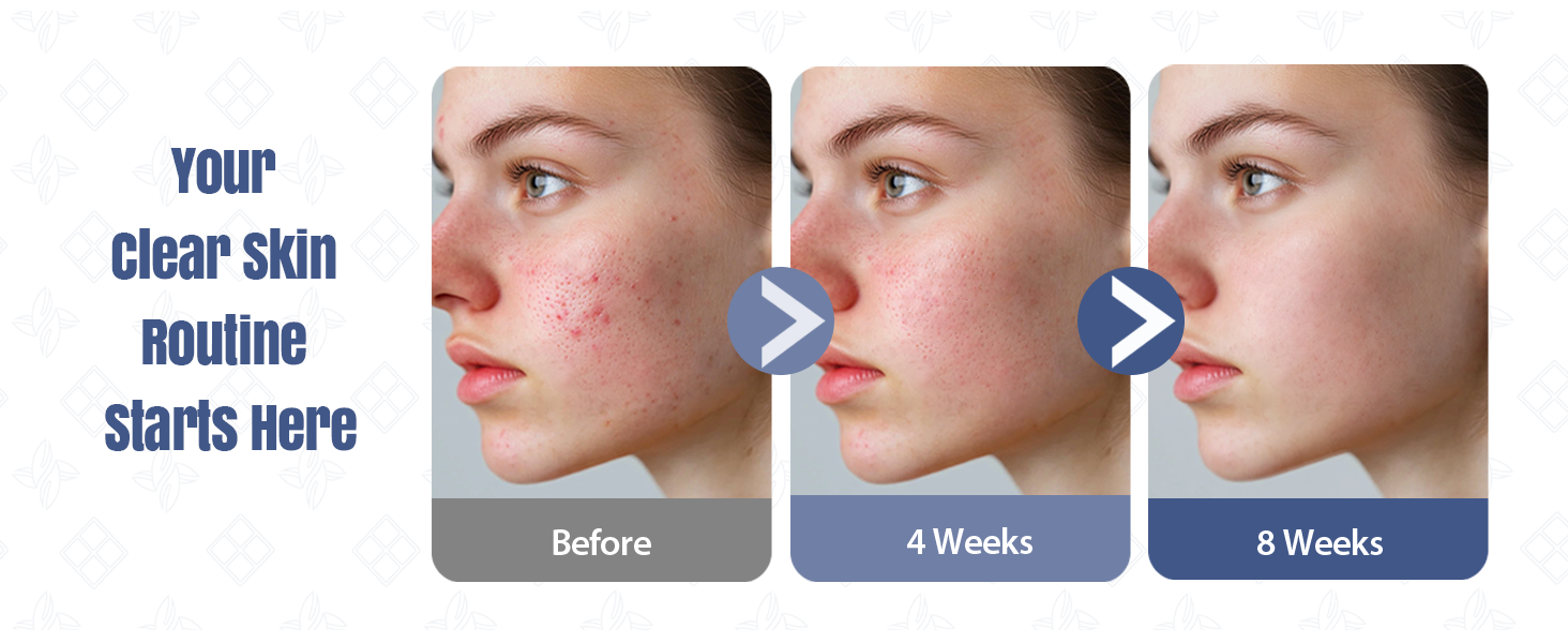 Your clear skin Routine Starts Here