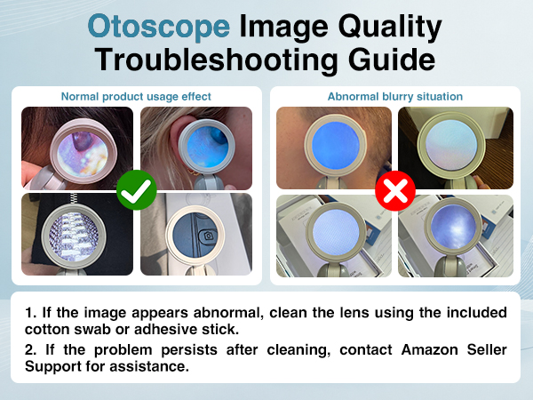 otoscope