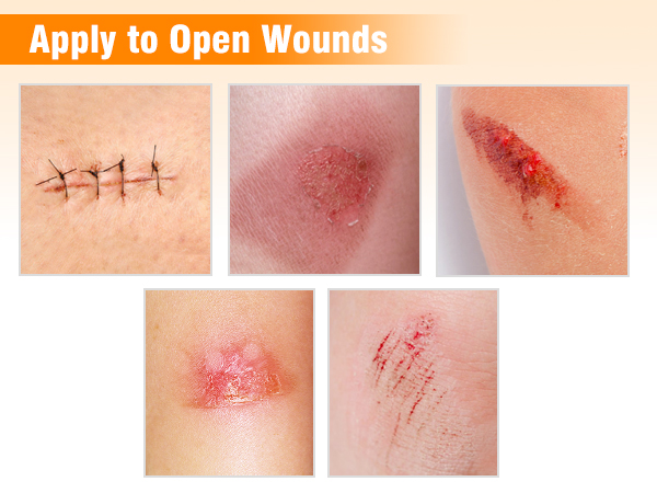 xeroform gauze dressing
