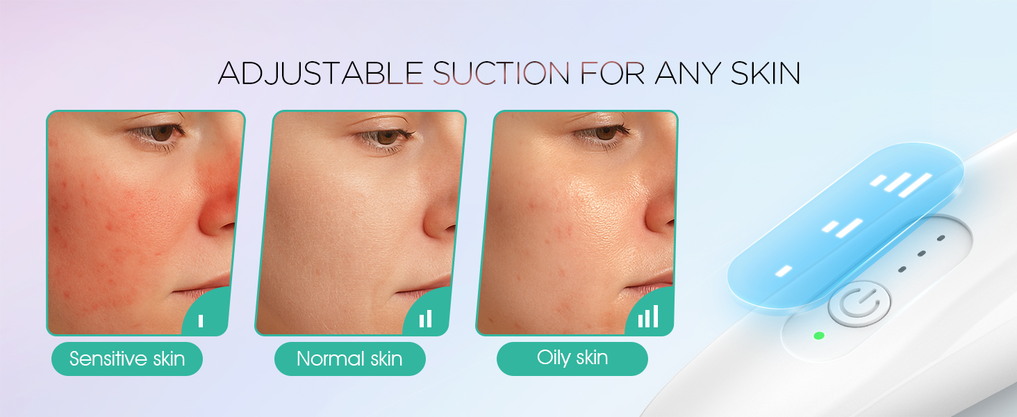 blackhead remover tools