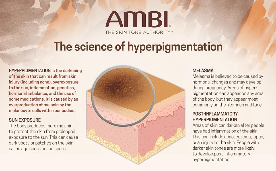 The science of hyperpigmentation