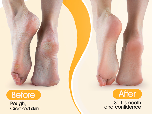 Foot Care Tool for Women and Men