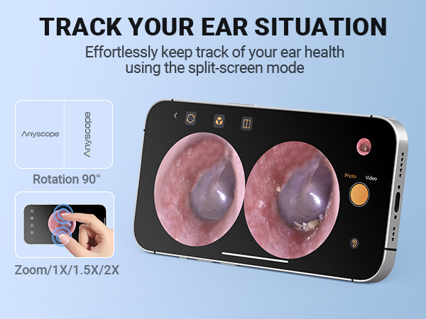 Otoscope with Light