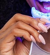 whitening teeth kit