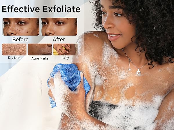 Renew Skin