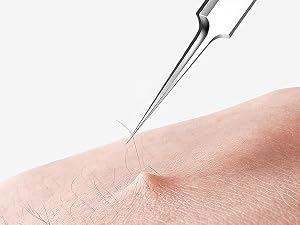 Ingrown Hairs Tweezers