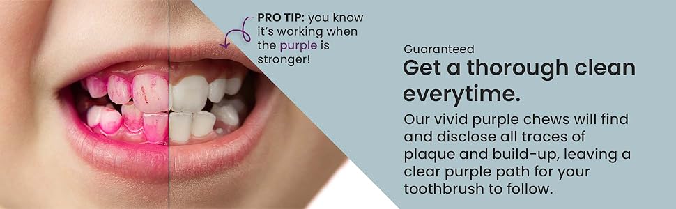 teeth brushing tablets dental disclosing tablets for kids tablets that show plaque plaque disclosing