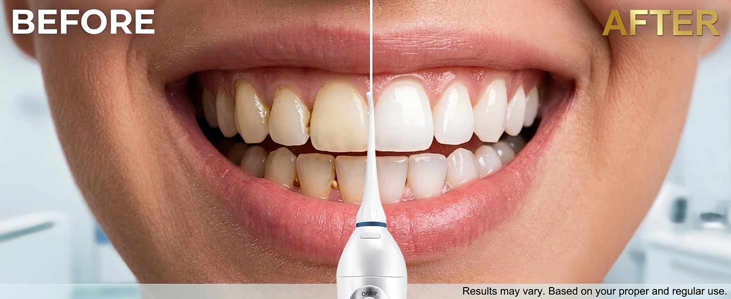cordless water flosser