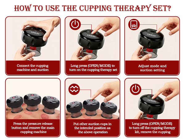 cupping set