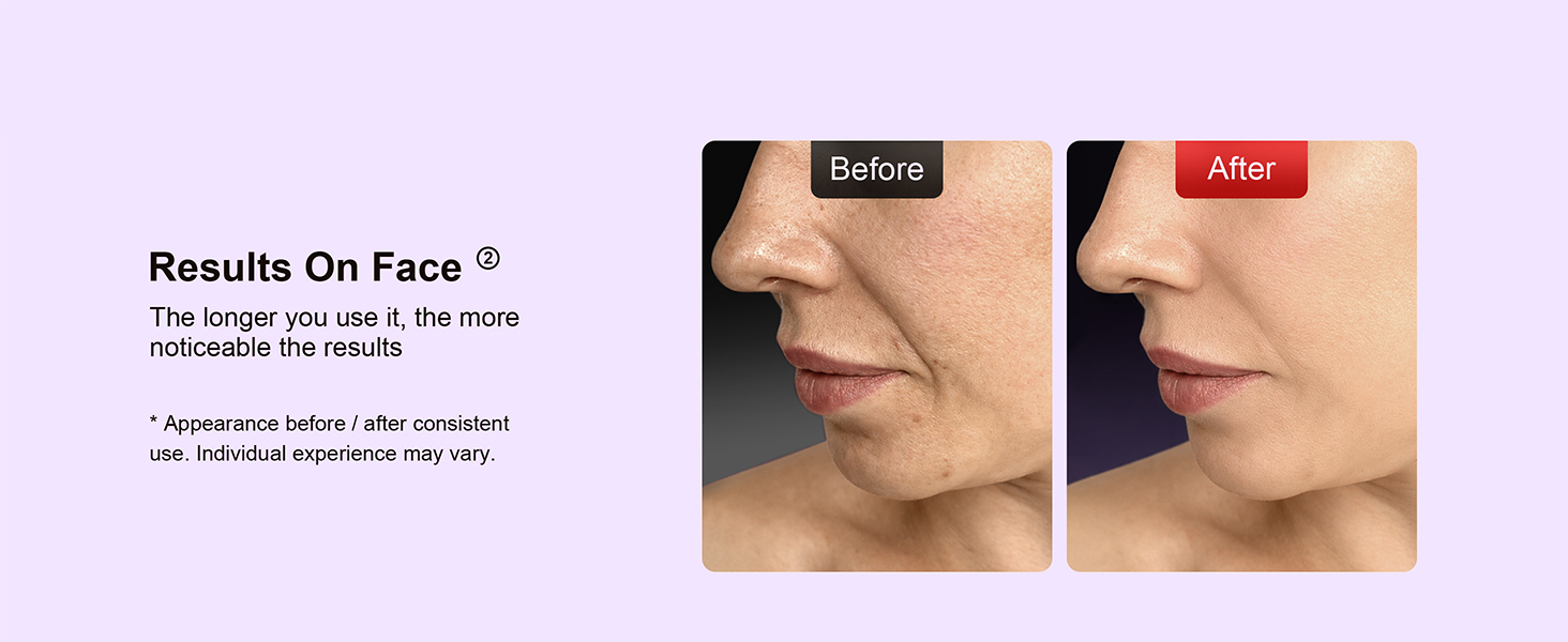 skin care tools