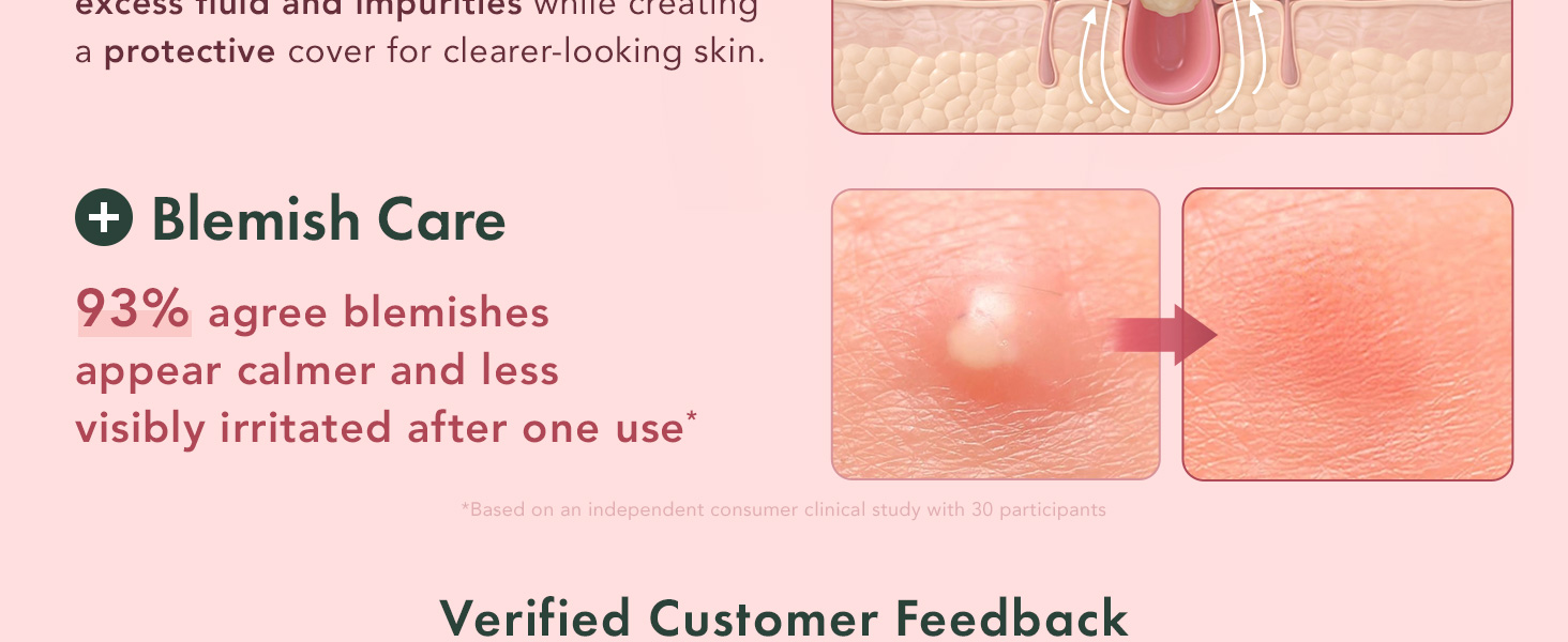 Rael, pimple patches, acne patches, pimple patches for face, Miracle Invisible Spot Cover hydrating