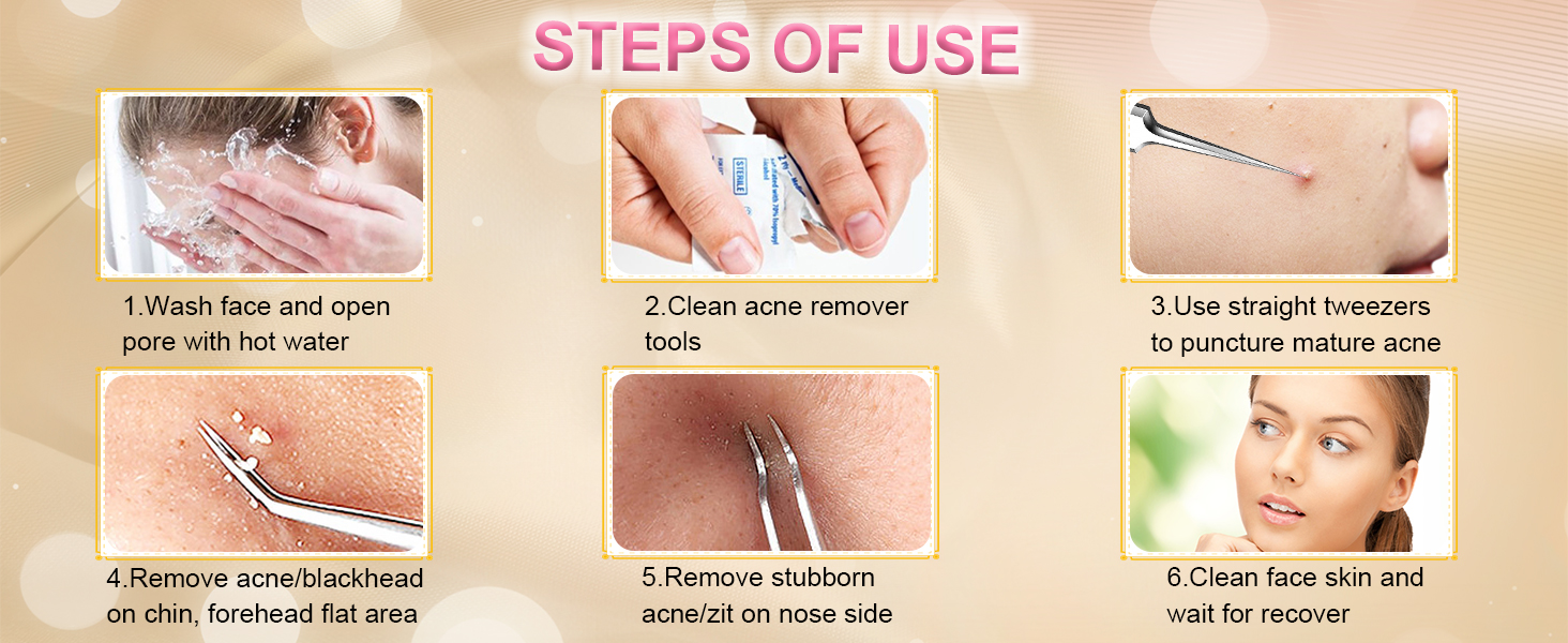 pimple extractor