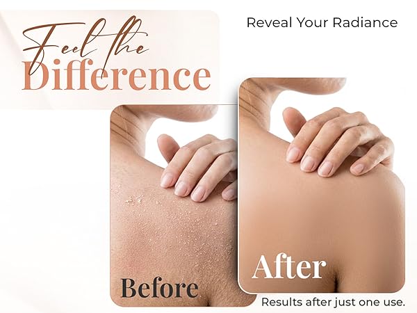 before and afer use of our L'Exfose exfoliating glove