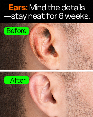 ear hair removal for men ear hair removal