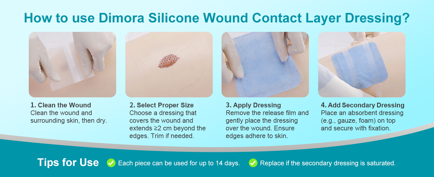 wound dressing