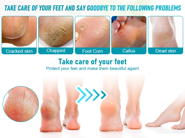 pedicure tools for feet