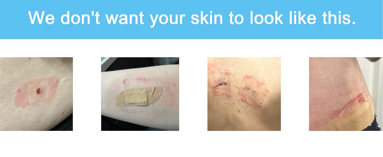 sensitive skin bandages