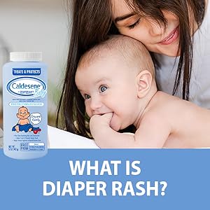 What is diaper rash?