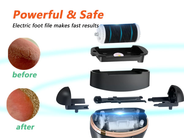 rechargeable foot callus remover