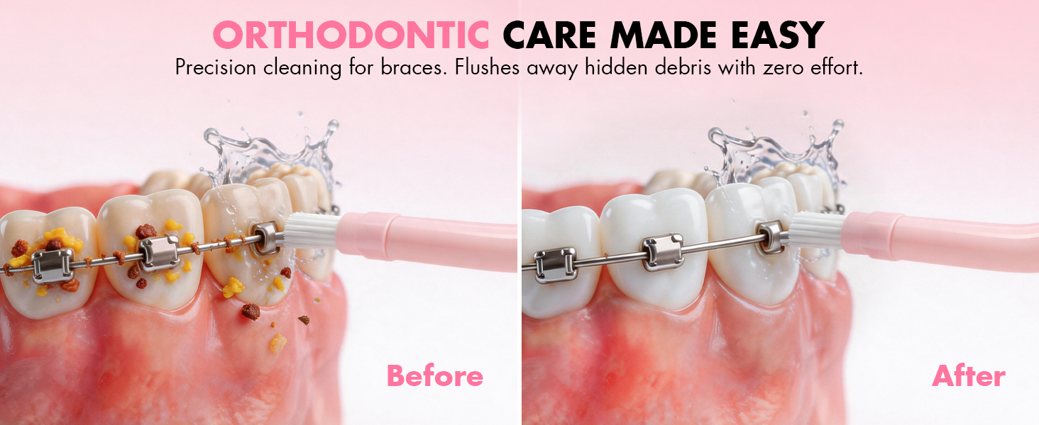 water flossers for braces