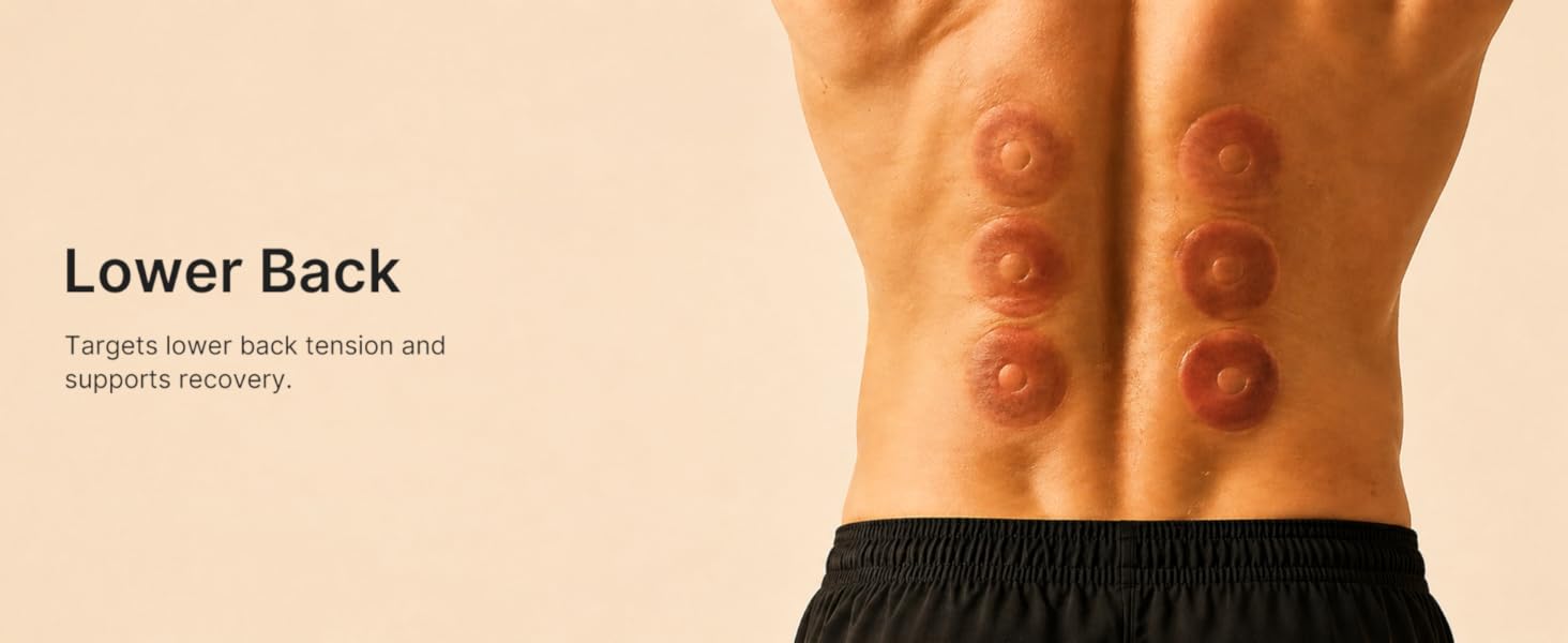 cupping therapy set