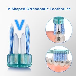 toothbrush for braces
