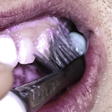 Long And Short Bristles Throughout Toothbrush for Adults Braces Cavities Gum Disease