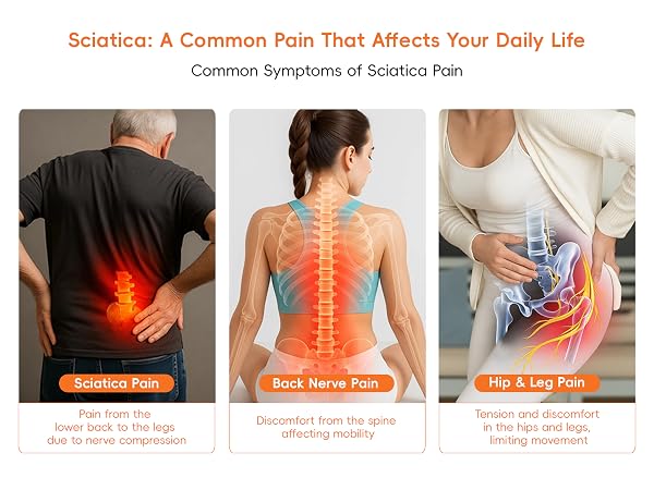 sciatica