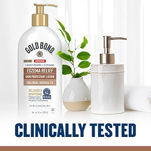 hsa fsa OTC eczema treatment