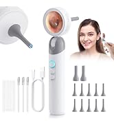 Otoscope Ear Camera with 1.38” Screen, 1080P HD Ear Scope & 4 LED Lights for Adult Kid and Pet, 1...