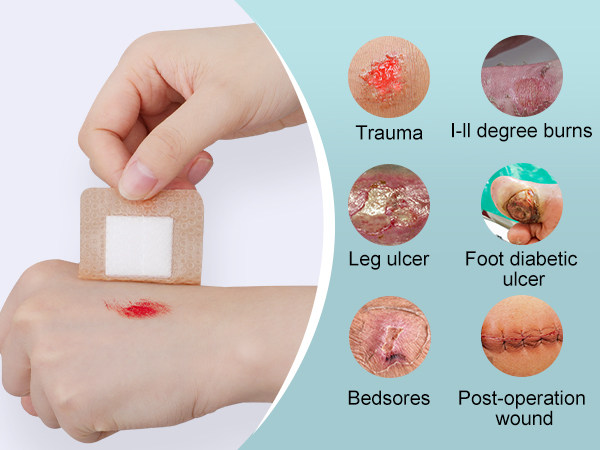 Silicone Foam Dressing
