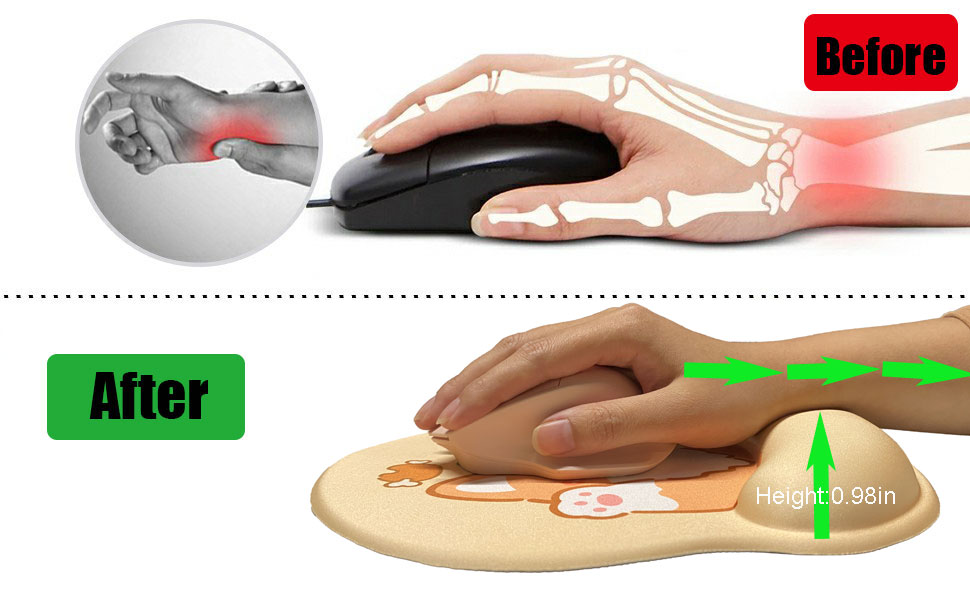 hand pain relief