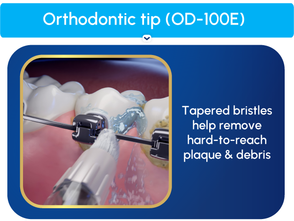 Image of Orthodontic Flossing tip with text reading tapered bristles to remove hard to reach plaque.
