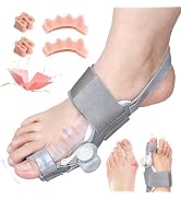 Nuaoi Bunion Corrector for Women Big Toe - Upgraded Bunion Corrector for Women Men Orthopedic Spl...