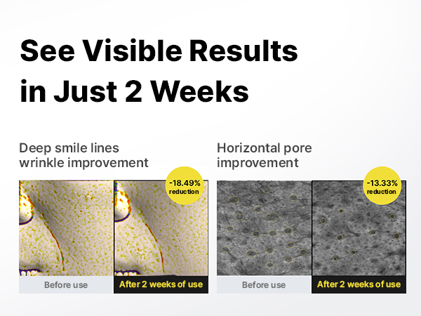 retinal booster
