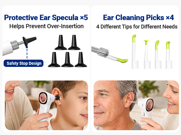 SA160 otoscope camera