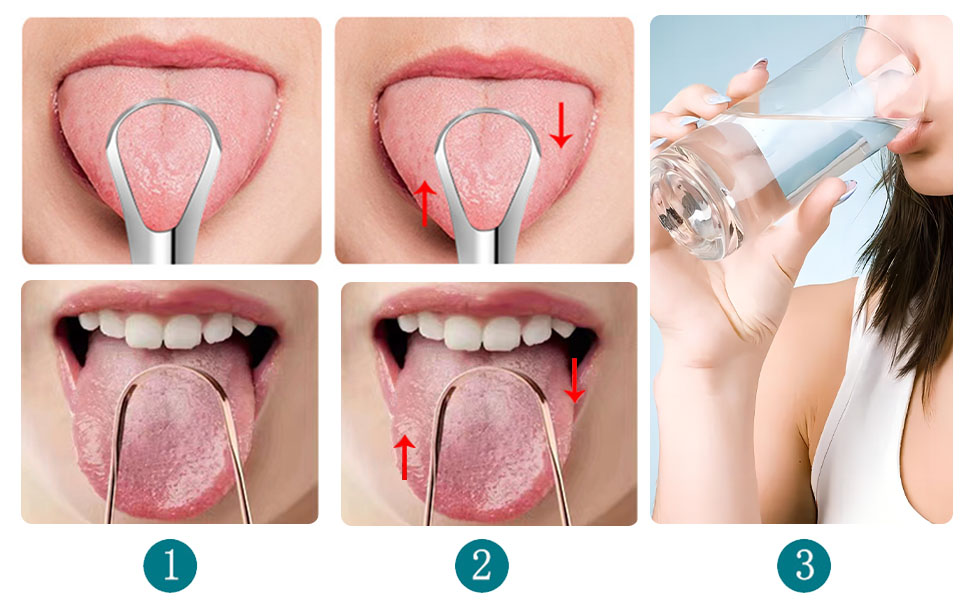 oral care